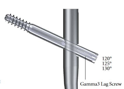 LAG SCREW, stainless steel, Ø 10.5 x 90 mm, sterile