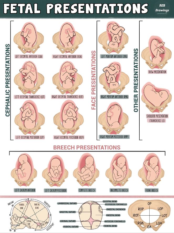 POSTER, FOETAL PRESENTATIONS 30x42cm