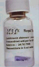 LEISHMANIASIS Kala Azar TEST (DAT), freeze-dried, ser/wb,5ml