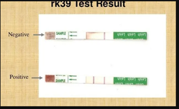 [SSDTLEIDS2-] (test leishmaniose Kala Azar) SERUM DE CONTROLE, négatif