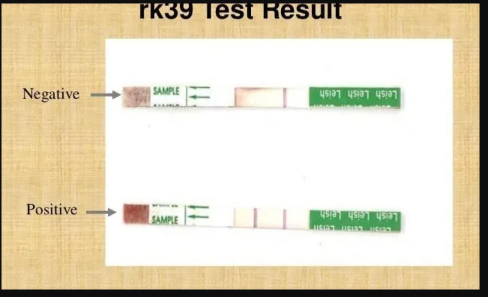 (test leishmaniose Kala Azar) SERUM DE CONTROLE, positif