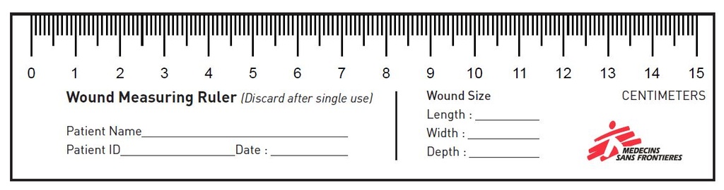 WOUND MEASURE RULER, paper sheet, English, A4, recto