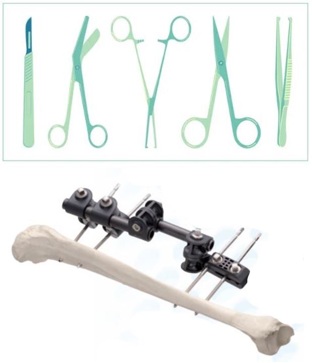 SET FRACTURE OUVERTE, instruments + fixateur externe GexFix