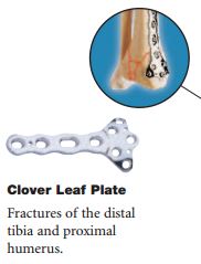 CLOVERLEAF PLATE, 4 holes, 80 mm