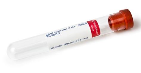 (s.prél.sang.) TUBE SOUS VIDE, plastique, SEC, 2ml, rouge