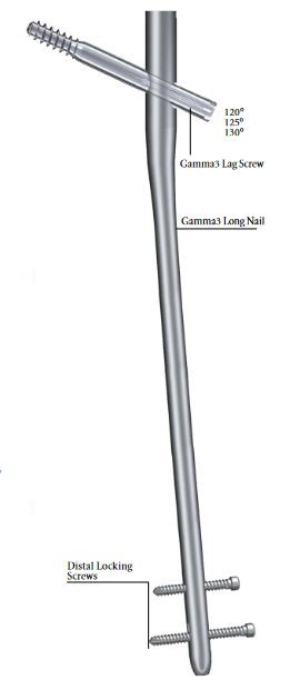 CLOU GAMMA3 LONG, R1.5 Ti, droit, 130°, Ø11mm, 340mm, stér.