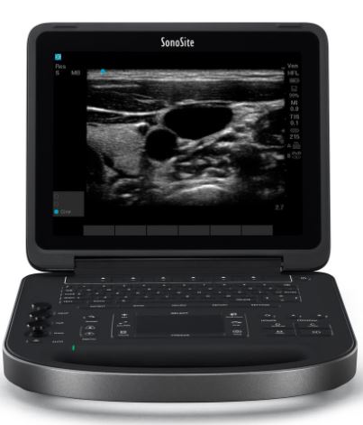 ULTRASOUND (Sonosite Edge 2) + TRANSDUCER rC60xi, armored c.