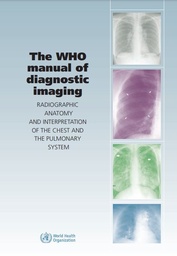 [L012XRAX09E-P] WHO manual of D.I. X-ray anatomy: chest & pulmon. system