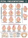 POSTER, FOETAL PRESENTATIONS 30x42cm