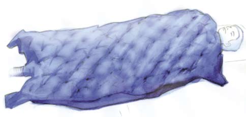 (warming unit) WARMING BLANKET, full body, ref. 92157