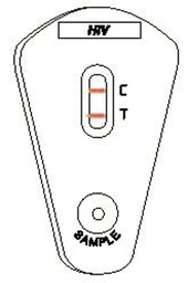 [SSDTHIVU20T] HIV 1 + 2 TEST (Uni-Gold), ser/pl/wb, 1 test 1206502