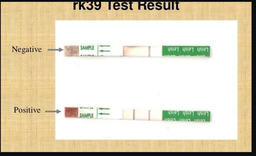 [SSDTLEIDS4-] (leishmaniasis Kala Azar test) CONTROL SERUM, positive