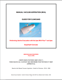 [L009OBSM01EFP] Manual vacuum aspiration. Guide for clinicians