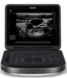 [EDIMULSE8--] ULTRASOUND (Sonosite Edge 2) + TRANSDUCER rC60xi, armored c.