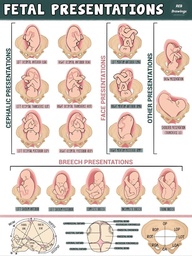 [ETPOFOET2--] POSTER, FOETAL PRESENTATIONS 30x42cm